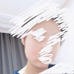 [댓글부탁해] <b>홍조</b> 없애는 방법 좀 제발ㅠㅠㅜ