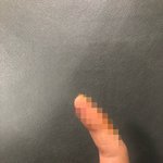 [도와주세요] 저와 강아지가 진돗개한테 물렸어요