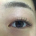 나 <b>쌍</b>커풀