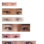 [댓글부탁해] 남자 쌍커풀 <b>성공후기</b>