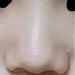 1년만에 코 변천사 좀 보소...