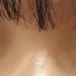 나 지금 <b>속</b><b>쌍</b>인데 쌍수할까
