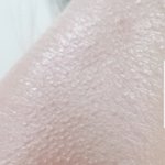 [조언부탁해] 내피부 어케 (혐주의