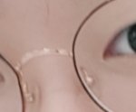 [드루와] 중3 쌍수후기