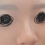 [댓글부탁해] 나 콧볼 <b>축소</b> 할까