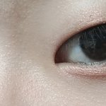나 1월에 쌍수하는데 지금눈 어떤지 봐주라 ㅠㅠ
