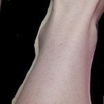 [댓글부탁해] 다이어트하고나서 다리에(약혐)