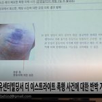 [소름실화] 더 이스트라이트, 폭행 사건 반박 기자<b>회견</b>··· 진실은?