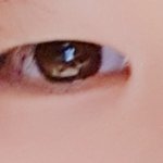 [드루와] 혐)오늘 쌍수한 사람의 쌍수후기