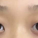 [댓글부탁해] 내눈 <b>소생</b> 가능하냐....ㅠㅠㅠㅠ