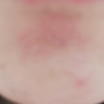 [조언부탁해] 이거 어케 <b>진정</b>시키냐 ... ㅈㅂ ㅠㅠㅠ