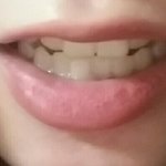 [댓글부탁해] 이거 부정<b>교합</b>이야? 교정인 들어와