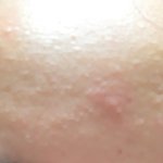 [꼭한번써봐] (광고X)여드름피부에좋은 기초<b>제품</b>+베이스 소개할게!