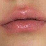이거 <b>입술</b> 왜이러는거야??ㅜ