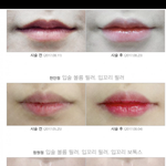 부산 입술<b>필러</b> 싸게맞게해줄게 들어와봐