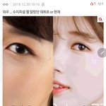 수지 쌍수? 어이없다 ㅎㅎ