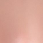 [댓글부탁해] 어제 <b>쌍수</b>했는데 <b>라인</b> 봐주라