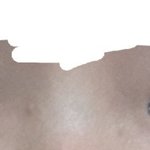 [ㅋㅋㅋㅋㅋ] 나 앞트임 해야될거같아? 그리고 쌍수라인 추천<b>해쥬</b>랑