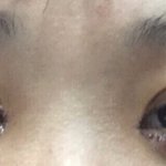 혐)<b>쌍수</b> <b>라인</b> 어떰?