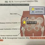 [충격] 선진국에서 엉덩이에 주사를 놓지 않는 이유