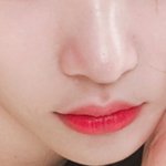 이거 모공임 아니면 여드름 <b>흉터</b>임?