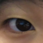 [댓글부탁해] 쌍수 평가 좀 해줘