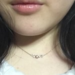 [댓글부탁해] 애들아 나 같은 애들 있니? 피부ㅠㅠㅠㅠ 사진있구...