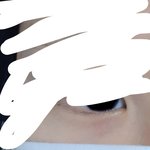 다크<b>서클</b>이 빨간색인데 정상이냐