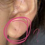 귀 뚫은 부분이 까매졌는데 이거 뭐임?