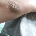 [댓글부탁해] 이 팔꿈치 검은 거 많이 <b>티나</b>..?