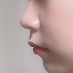 [댓글부탁해] (사진)나 앞모습은 이쁘단말 듣는데 옆모습 진짜 답...