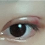 [댓글부탁해] 나 쌍수 얇게 된 거 같음???