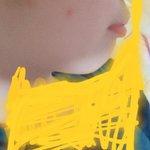 [조언부탁해] 교정한 애들아 들어와줘