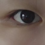 [댓글부탁해] 쌍수ㅠㅠ 사진있어 도와줘