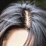 [댓글부탁해] 본진 <b>탈모</b> 진단좀  해줄분? ㅈㅂ