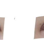 ㅅㅂ 쌍수 절개만했는데 <b>점막</b>들림 왤케심함