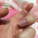 <b>손톱</b>에 왜 저런거얌