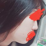 [댓글부탁해] 나 <b>턱살</b> 어떡함ㅅㅂㅅㅂ이거 빠지니