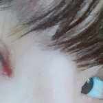 나 코성형 했는데 모양좀 봐줘ㅠ