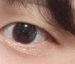 [드루와] <b>눈사진</b>있) 성형 어디어디할까