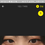 쌍수해야할까요...?