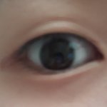 눈에 살없는 <b>무쌍</b>인데 쌍수