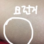 [댓글부탁해] 이거 <b>모공</b>각화증이야?ㅠ̑̈