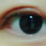 나 <b>쌍수</b> 망한거지?