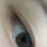 쌍커<b>풀</b> 너무 잘 풀려서 쌍수함