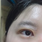 [댓글부탁해] 나 오늘 쌍수 한 지 5일 짼데 라인 나무 얇다아님...