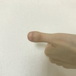 [이것좀봐줘] 엄지손가락이 제 복덩이가 되겠쥬?