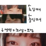 [드루와] 기다리고 기다리던 쌍수 절개 <b>한달차</b> 후기