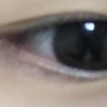 내 <b>눈</b> 보고 필요한 <b>수술</b> 좀 말해주라