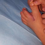 [목욕탕] 라**사우나. 다친아이발은 정말 시설물 <b>책임</b>은 없을까요?
